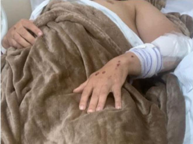 O jovem de Timóteo sofreu fratura na coluna e, nos últimos dias, sua rotina é ficar apenas deitado 