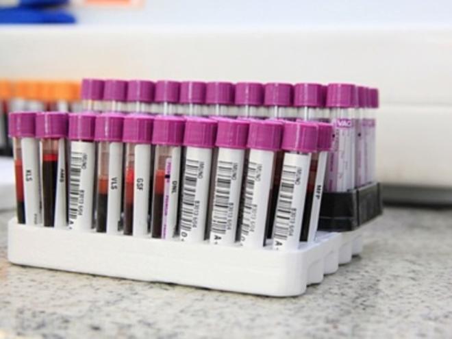 Qualquer pessoa que tenha boa saúde e não apresente doenças infecciosas ou hematológicas pode se cadastrar como doador voluntário de medula óssea