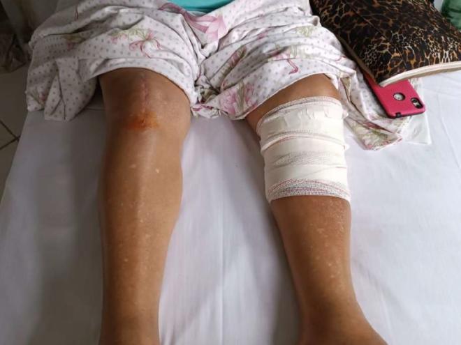 Queda aconteceu quando a mulher de 66 anos desembarcava na rodoviária de Coronel Fabriciano