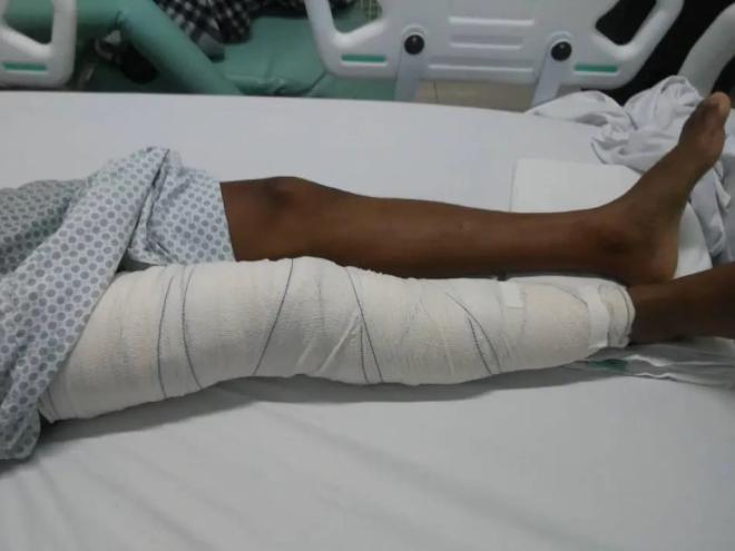 A operadora chegou a marcar cirurgia para Weudson mas, quando o paciente chegou a Belo Horizonte, foi informado que o procedimento fora negado