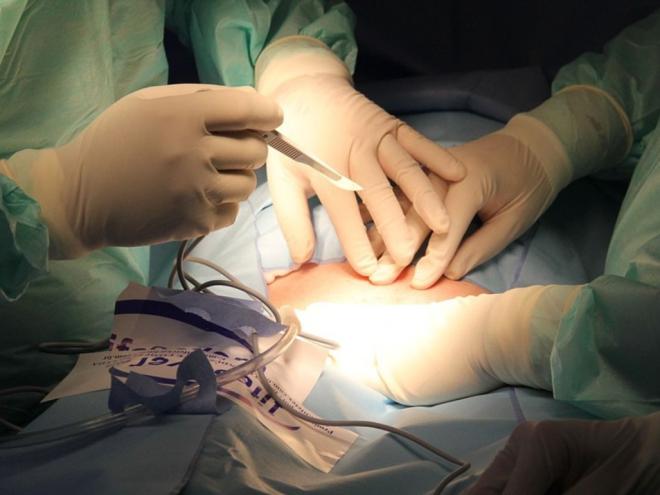 Justiça condena hospital, plano de saúde e médico a indenizar paciente por erro em cirurgia. Erro de médico acarretou graves sequelas permanentes (Imagem ilustrativa)