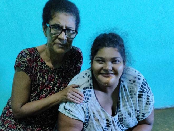 Marilda também cuida de sua filha tetraplégica 