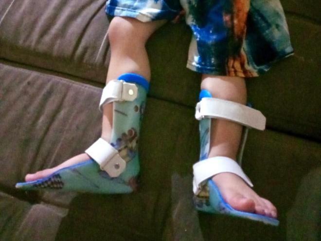 Davi foi diagnosticado com distrofia muscular de Duchenne em dezembro de 2021