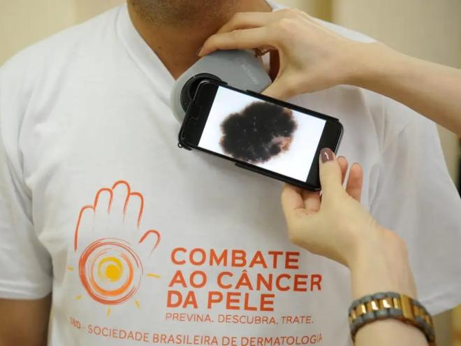 Devido ao calor intenso e à alta exposição ao sol durante o verão, é necessário tomar cuidados extras para proteger a pele