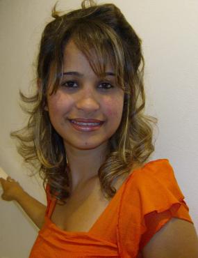 No rosto, nota-se o Rash Malar nas bochechas, em formato de asa de borboleta