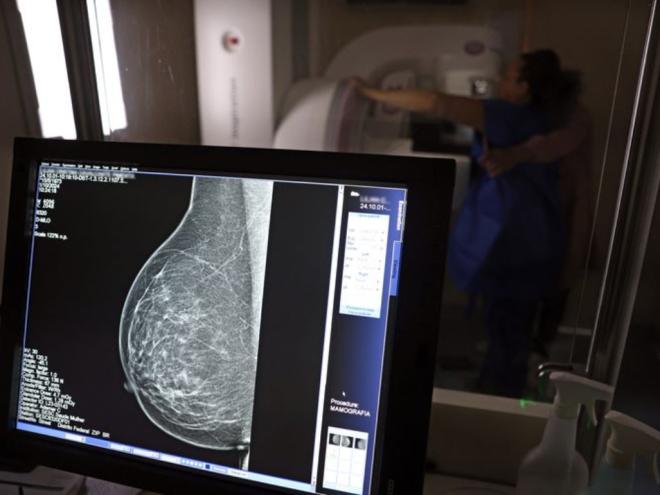 Teste de mamografia realizado na Campanha Outubro Rosa: Sesc-DF, que oferece exames e consultas gratuitas às mulheres.  Foto: José Cruz/Agência Brasil