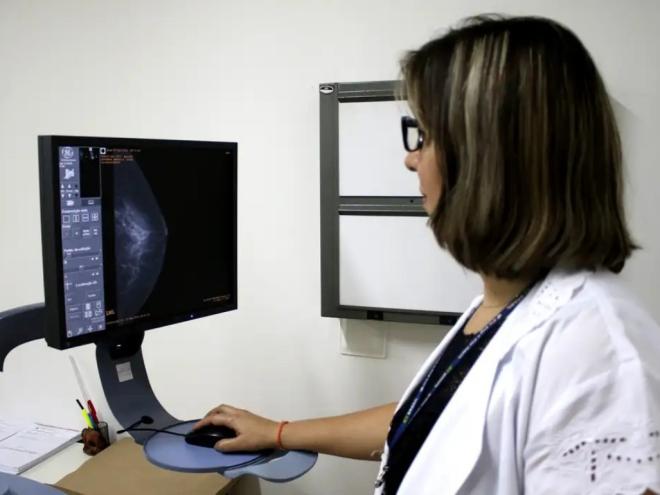 No Brasil, a cobertura da mamografia ainda é um desafio