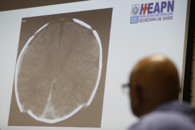 De acordo com a equipe médica do Hospital Estadual Adão Pereira Nunes, o bebê está com quadro de paraplegia, mas tem boas chances de recuperação