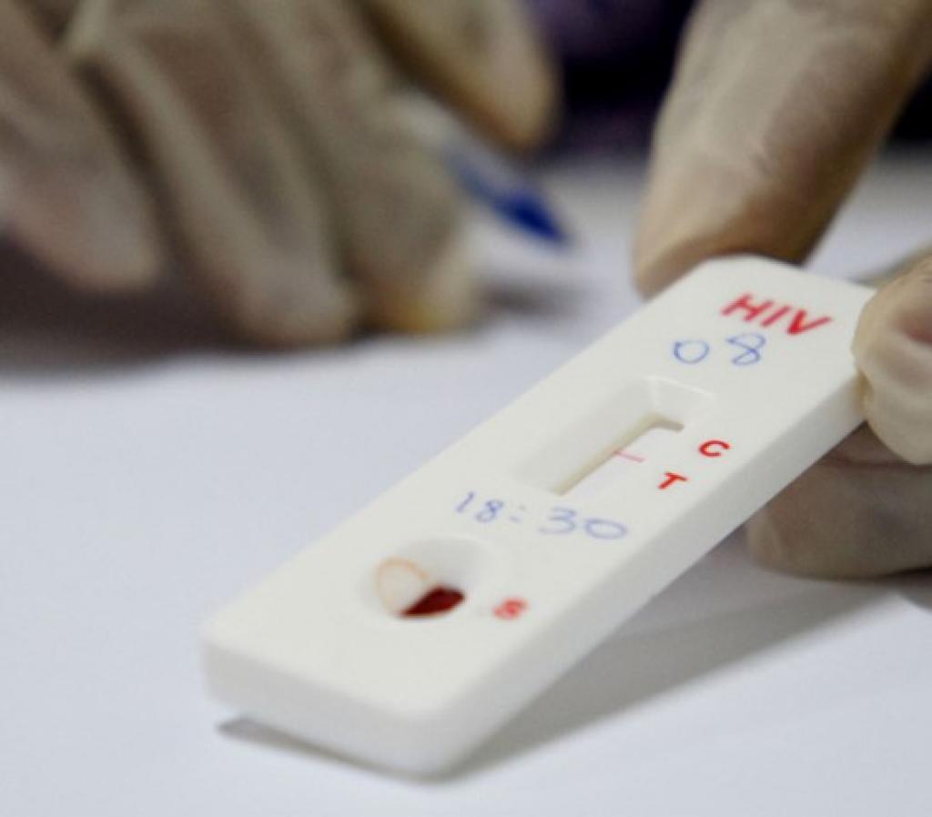 Testes rápidos de HIV são descentralizados em Coronel Fabriciano