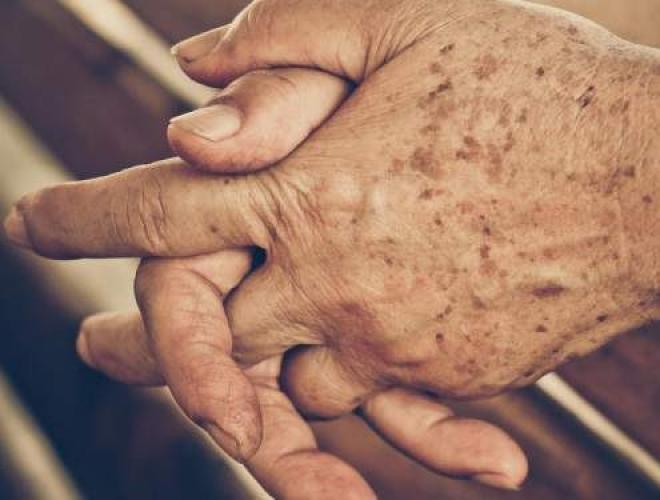 A dermatite, apesar de não ser uma condição específica desta faixa etária, aparece exatamente quando a pele vai perdendo sua hidratação e oleosidade natural