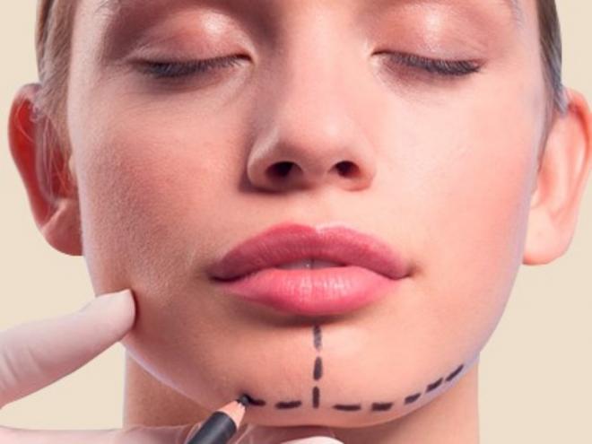 O motivo deste interesse repentino pela mentoplastia é que personalidades, como atores, cantores e modelos descobriram na técnica uma forma de melhorar a aparência facial