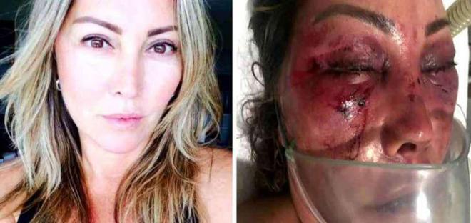 Elaine Perez Caparroz antes e depois das agressões 