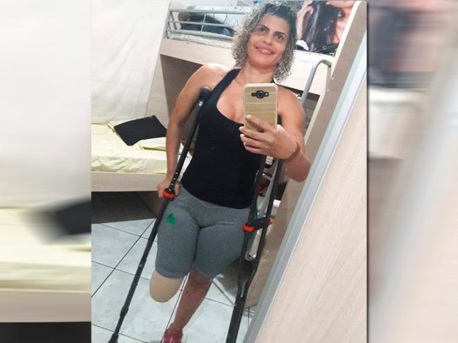 Fabíola Ribeiro informou ao Diário do Aço que deseja adquirir uma prótese 