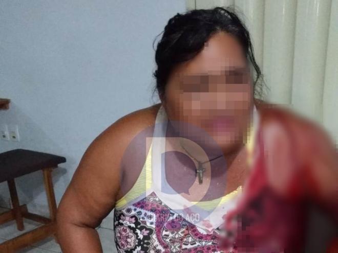A vítima foi socorrida pelo Samu e encaminhada para o Hospital Márcio Cunha