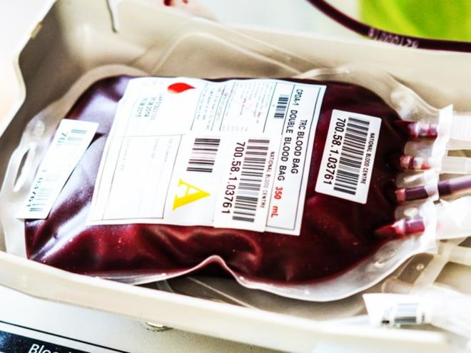 Exames de sangue são feitos pela Funed, para tentar identificar causa de doença que tem atingido homens em MG