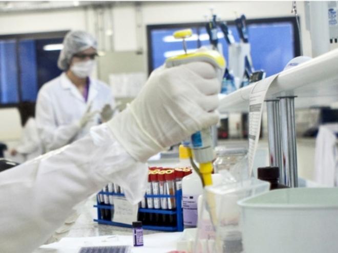 Exames são feitos no laboratório da Funed, em Belo Horizonte, para tentar definir causa da doença 