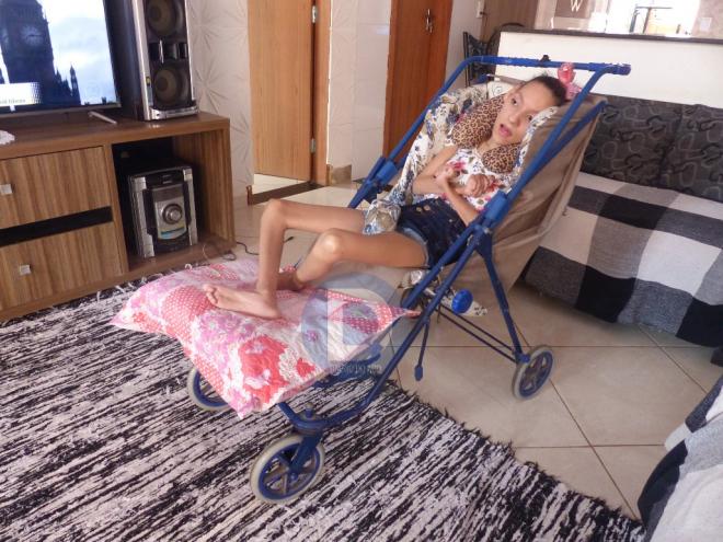Shayana Gonçalves Pereira tem 28 anos e nasceu com microcefalia 