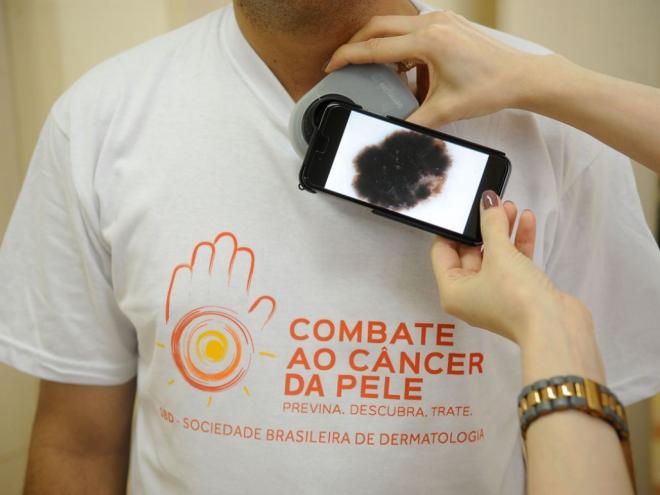 Até o momento, o programa computacional já alcançou 86% de precisão na identificação da doença
