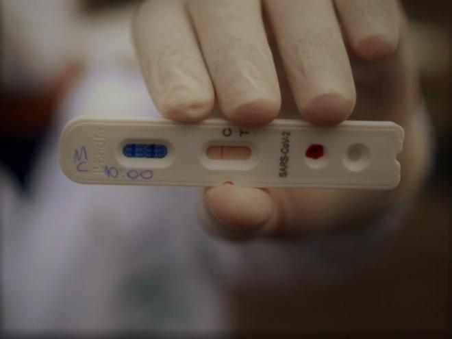Enquanto muitos zombam da pandemia, doença já levou quase 60 mil vidas e taxa de letalidade, índice dos que morrem ao contrair o vírus, chega a 4,3%