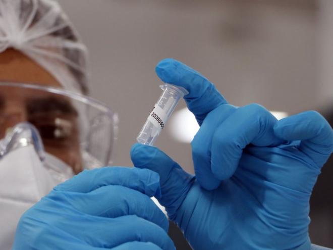 O número de óbitos desde o início da pandemia estava em 150.998 e  há 2.400 falecimentos em investigação