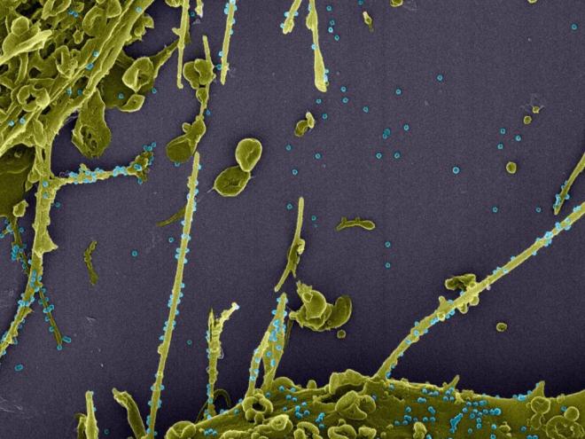 Medida é para conter o avanço da nova variante do coronavírus
