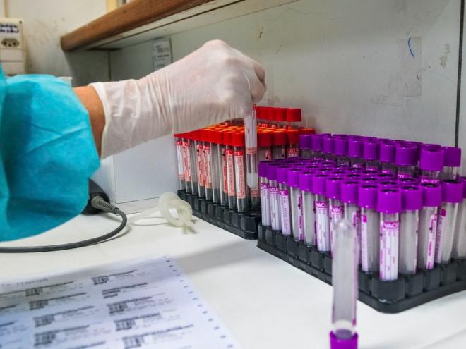 Instituto de Medicina Tropical identificou duas novas variantes