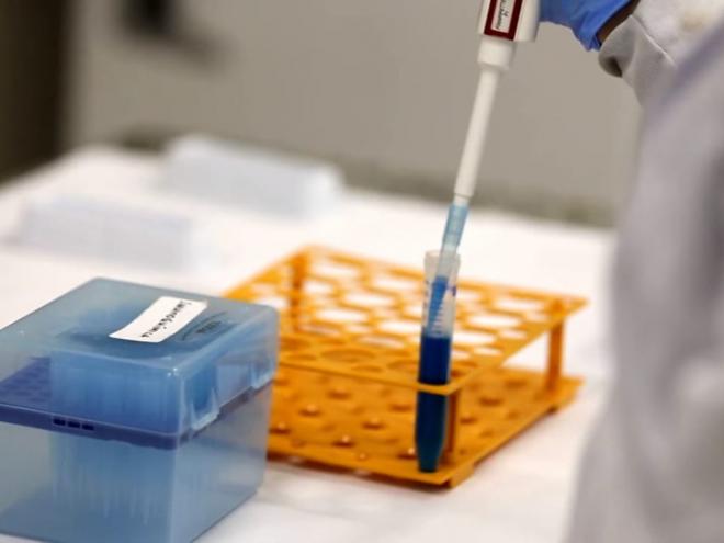 O exame é capaz de detectar a presença de anticorpos que combatem o novo coronavírus nas amostras de urina dos pacientes