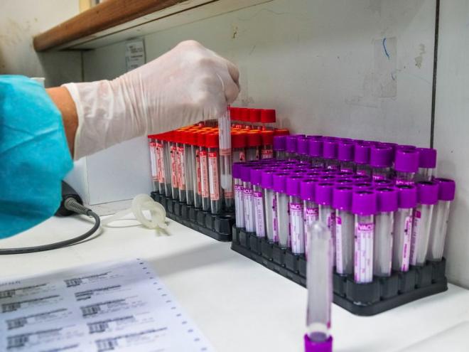 Nos últimos dois meses foram registrados 5.456 casos positivos na RMVA, dos quais, 2.772 em maio e 2.684 em junho, uma queda de 3%