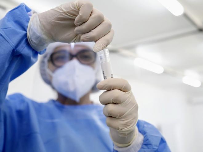 Ainda há 323.616 casos em acompanhamento. A definição é dada a casos ativos de pessoas que tiveram o diagnóstico confirmado e estão sendo atendidas por equipes de saúde ou se recuperam em casa.