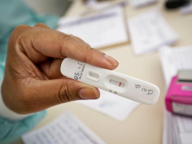 Os pesquisadores avaliaram que o número de óbitos pela doença no Brasil em 2020 está subestimado em pelo menos 18%