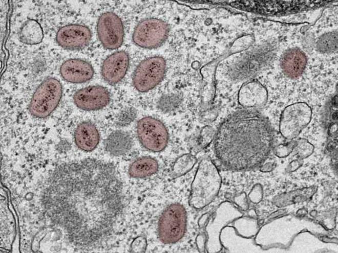 Imagem microscópica do monkeypox vírus isolado por pesquisadores da UFMG e da Funed; em tom rosado aparecem os vírus