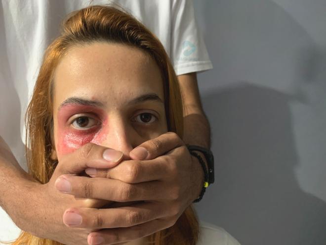 São várias as formas de agressões contra a mulher, a violência física é a mais conhecida 